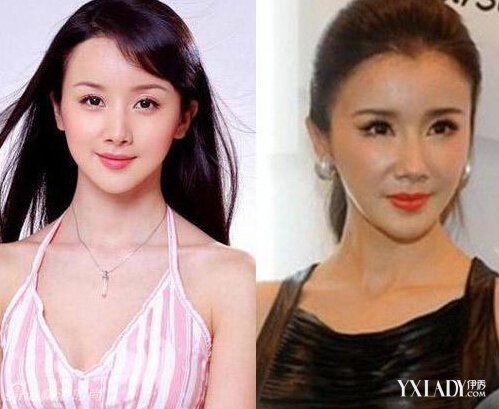 探秘明星整容的秘密，神秘美容小店的魅力所在！